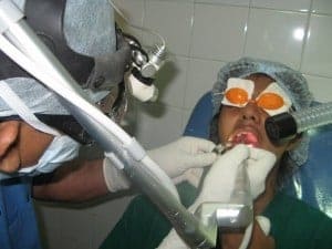 laser throat