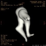 left ossicles2 left ossicles2