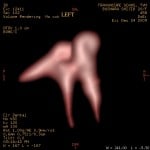 left ossicles7 left ossicles7