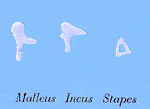 malleus incus stapes
