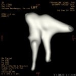 ossiclesleftear1 ossiclesleftear1