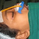 post op caldwel luc1