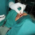 procedure