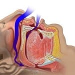 snoring mechanism2