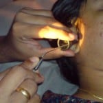 suction cleaning ear