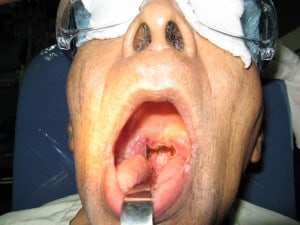 warrier4